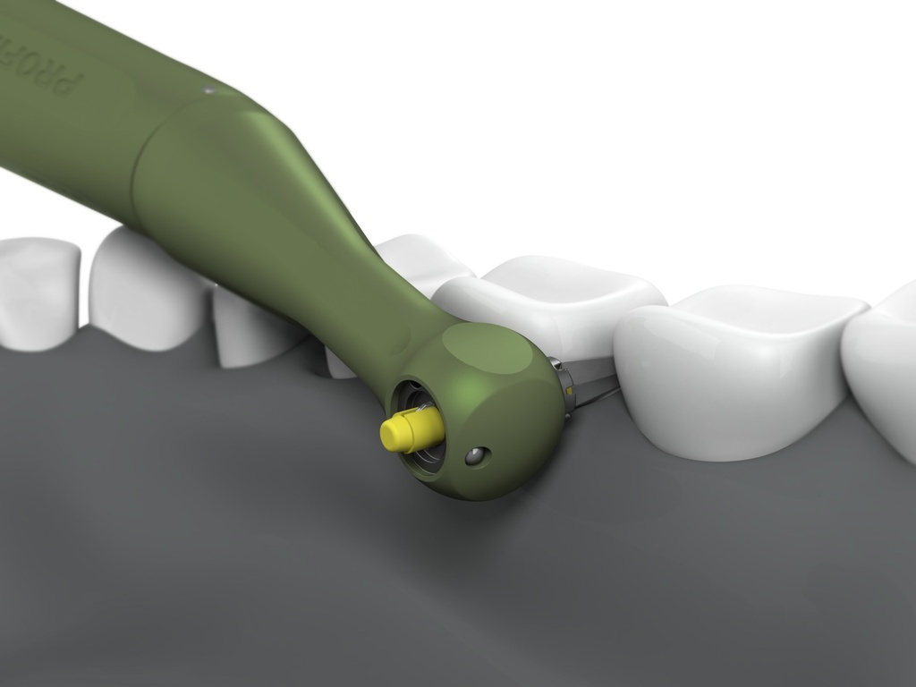 Dentatus Profin PDX – Contre-angle à mouvement alternatif (P – vue 3