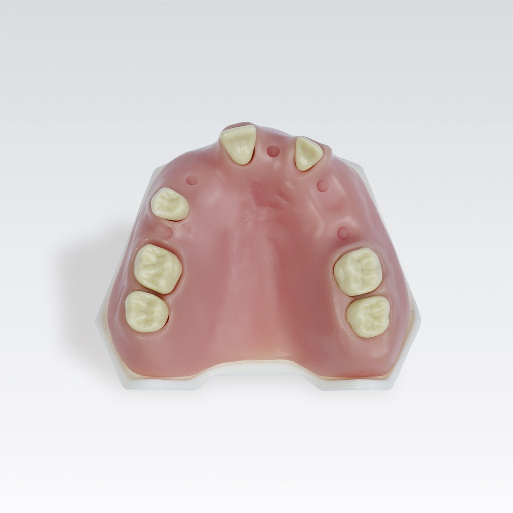 Frasaco Periimplantitismodell Ober- kiefer – Ref. A-PB PI OK