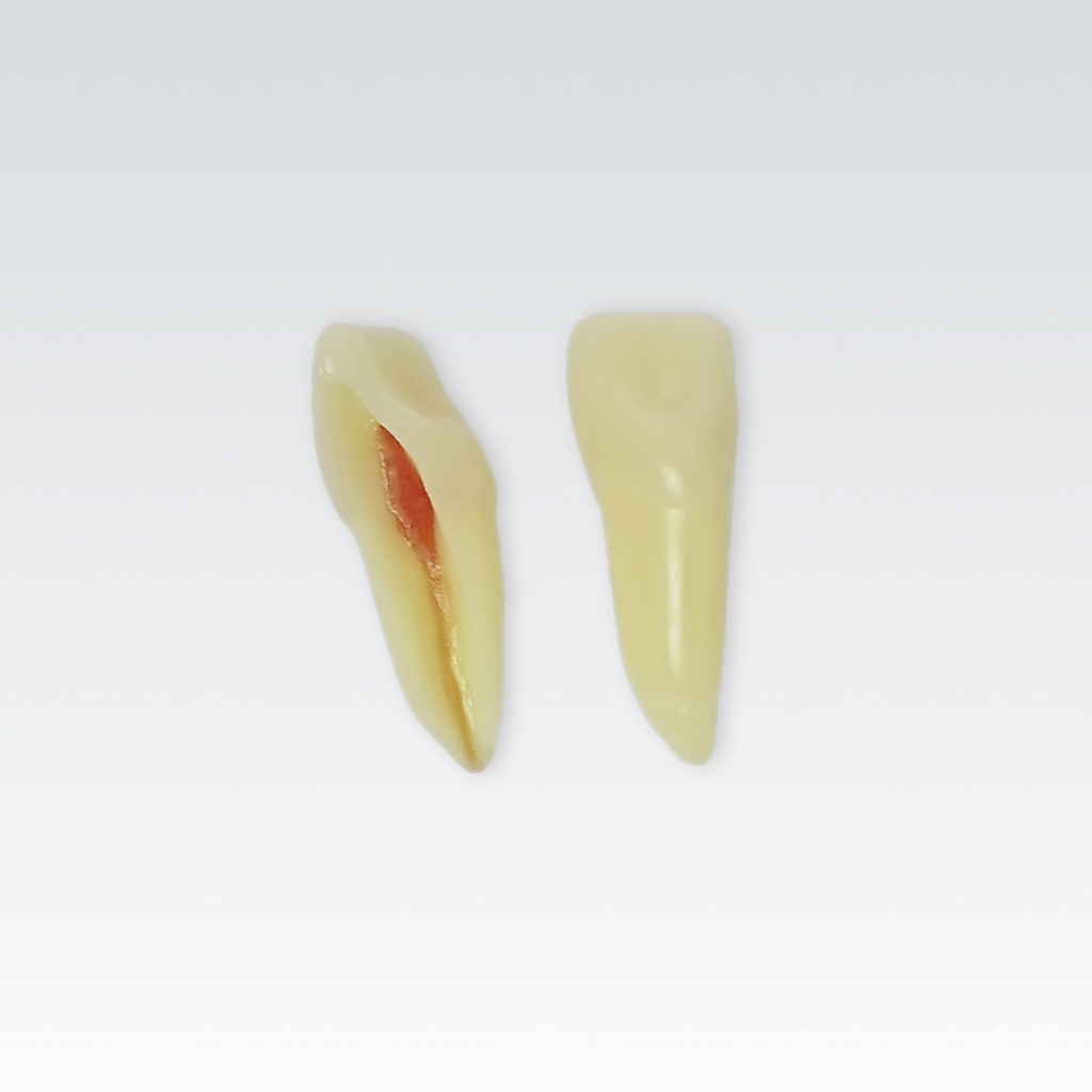 Frasaco Dent endodontique no. 11 avec racine naturelle capable de rayons X, 3 couches – réf. ANA-4 Z3RN-11