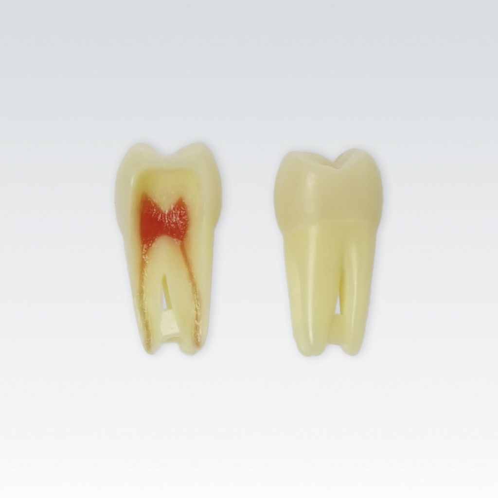 Frasaco Dent endodontique no. 16 avec racine naturelle capable de rayons X, 3 couches – réf. ANA-4 Z3RN-16